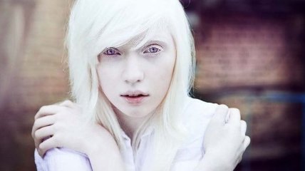 Необычная человеческая красота: люди-альбиносы, которые разительно отличаются от всех (Фото)