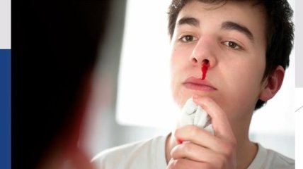 Чому йде кров з носа і як її зупинити