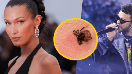 Белла Хадид и Джастин Тимберлейк борются с болезнью Лайма