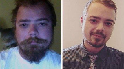 До и после: как меняется внешность человека, который перестает пить (Фото)