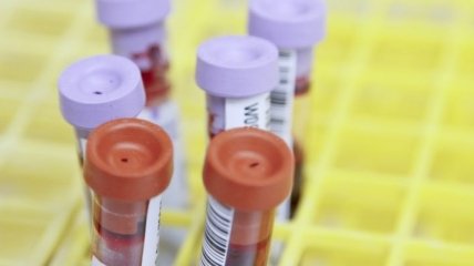 В Черкасской области четверо врачей заразились на коронавирус