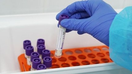 В Винницкой области коронавирус обнаружили у 24 детей