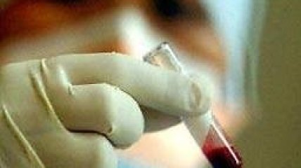 В Египте от неизвестного вируса гибнут дети