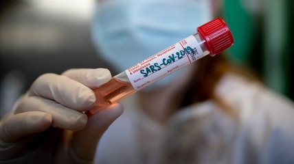 В Україні зафіксовано 2777 випадків коронавірусної хвороби