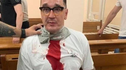 Одеський блогер Домбровський полоснув себе лезом по горлу в суді