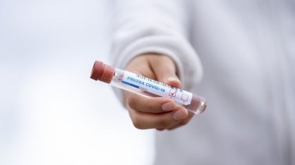 Кількість випадків коронавірусу у Бельгії перевищили 49 тисяч