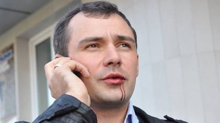 В Житомире напали на лидера партии "Демократический Альянс"