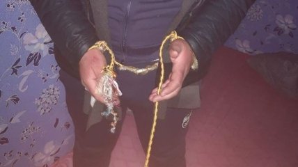 Связали, били и унижали: в полиции рассказали о похищении стоматолога в Харькове (фото, видео)