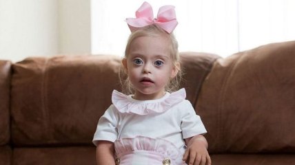 Двухлетняя модель с синдромом Дауна покоряет сердца людей (Фото) 