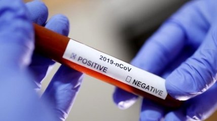 Перший випадок зараження коронавірусом зафіксовано у Молдові 