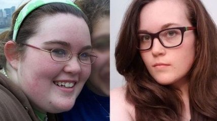 До и после: снимки женщин, которые побороли лишний вес (Фото)