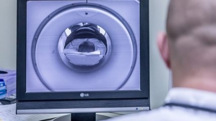 Не хуже врачей: ИИ научили ставить диагнозы по МРТ 