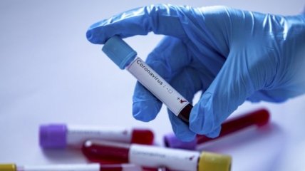 Австрійська компанія заявляє, що винайшла найшвидший у світі тест на коронавірус