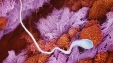 Уникальные снимки эволюции эмбриона человека от зачатия до рождения (Фото)