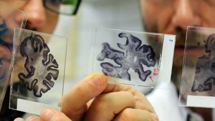 Новое открытие может помочь предотвратить старение мозга