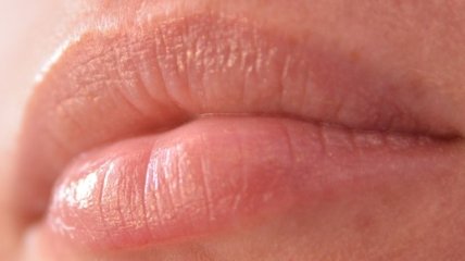 Как избавиться от белых точек на губах?
