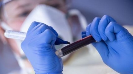 Более 10 тысяч новых случаев за сутки: свежие данные по коронавирусу в Украине