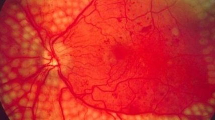 Google DeepMind научится диагностировать заболевания по глазным снимкам 