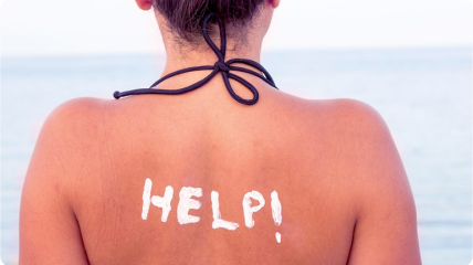 Шкіра може дуже болісно відреагувати на сонячні промені