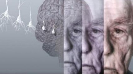 Ученые разработали лекарство нейростатин от болезни Альцгеймера