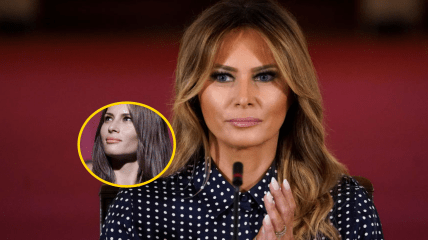 Мелания Трамп до и после пластики