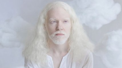 Поистине гипнотическая красота альбиносов (Фото)