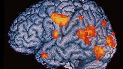 Ученые: Мозг человека способен самостоятельно излечиваться от шизофрении