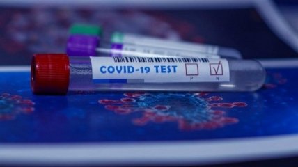 В Украине уже более 400 тысяч случаев коронавируса: статистика на 2 ноября