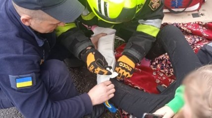 Спасатели оказали первую помощь пострадавшей девочке