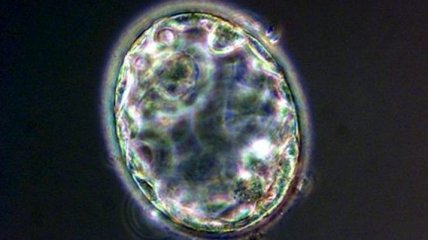 Ученые засняли формирование лица эмбриона