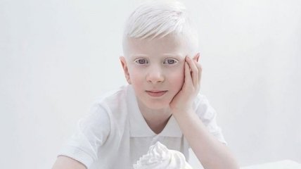 Белоснежная красота людей-альбиносов в завораживающих творческих снимках (Фото) 