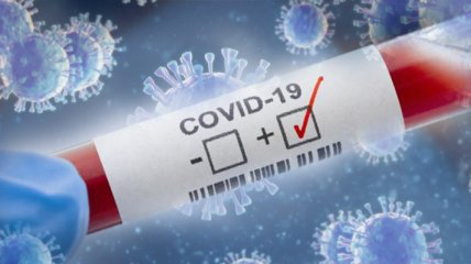 Украина второй день подряд бьет суточный рекорд смертности от COVID-19 с начала пандемии