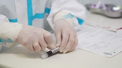 В Украине больше 10,5 тыс. новых случаев коронавируса: где ситуация хуже всего