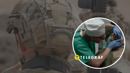 ССО, кадри з фільму "Дантист"