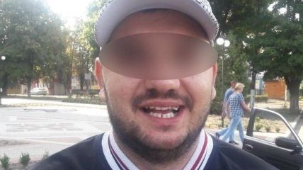 Удар ножом в спину: в Киеве мужчина получил ранение за замечание