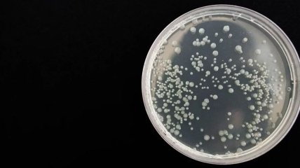 Пластиковое загрязнение: обнаружен микроорганизм, способный перерабатывать изделия из полиуретана