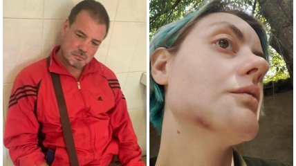 Круговая порука: в Ужгороде пьяный военком избил женщину на улице, но дело пытаются замять