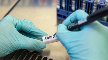 На Ровенщине подтверждены 25 новых случаев коронавируса