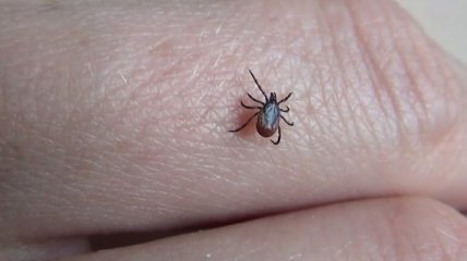 Сезон клещей: как уберечь себя от укусов насекомых (Видео)
