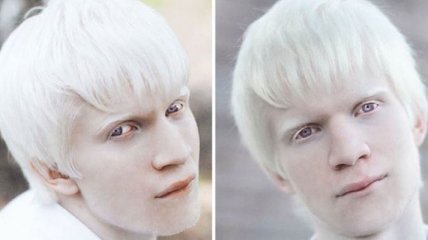 Фарфоровая красота: завораживающие глаз альбиносы (Фото) 