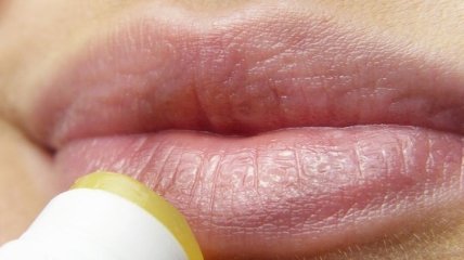 Что можно узнать о здоровье по состоянию губ 