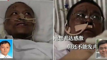 Потемнела кожа: Что с китайскими врачами, заразившимися COVID-19