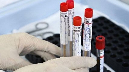  В Ровенской области выявили 66 новых случаев коронавируса, всего 3155