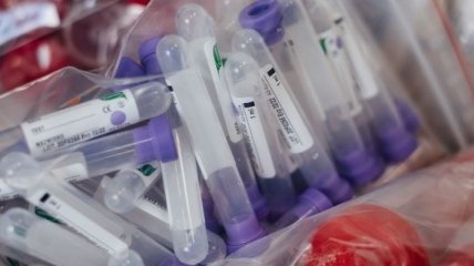 МОЗ визначиться з використанням тестів на антитіла
