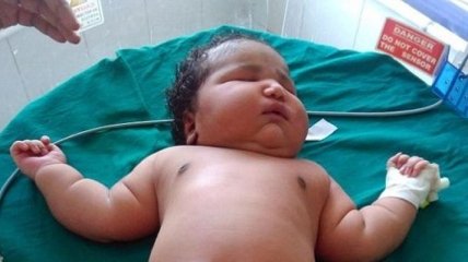В Индии родился "самый тяжелый" в мире  ребенок