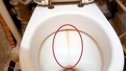 Как отчистить желтую полоску в унитазе - простой способ