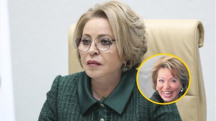 Без ретуші та вдалих ракурсів: у мережі звернули увагу на справжнє обличчя Вальки-стакан