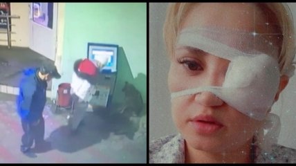 Собака едва не лишила глаза девушку в Крыму: момент происшествия попал на видео