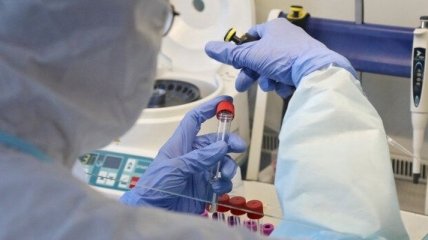 Кількість інфікованих коронавірусом у Росії перевищила 74,5 тисячі