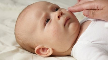 Аллергия у новорожденных: как проявляется и что делать